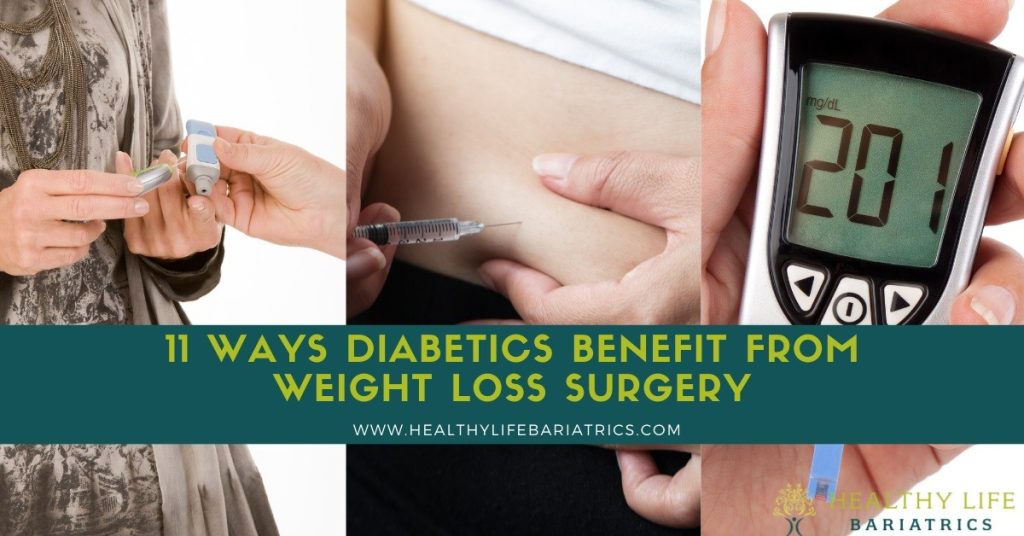 Diabetes and Weight Loss Surgery