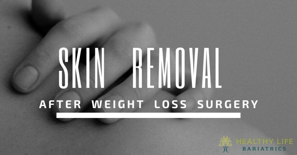 Skin Removal after Bariatric Surgery