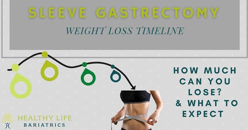 Sleeve Gastrectomy Weight Loss Timeline in Los Angeles