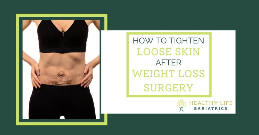 Tighten Loose Skin