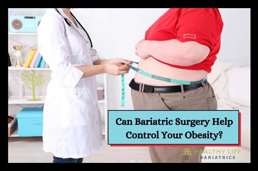 Control Obesity with Bariatric Surgery