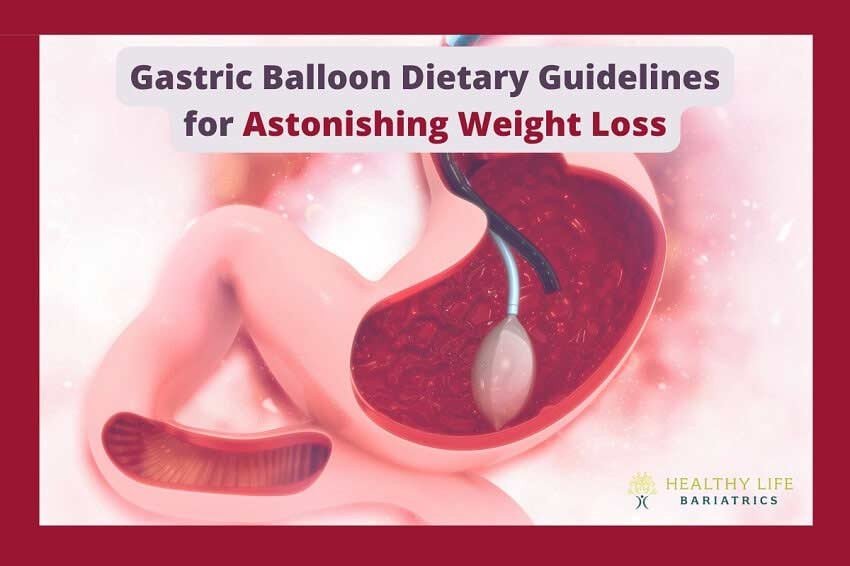 Gastric Balloon Dietary Guidelines for Weight Loss, Los Angeles, CA