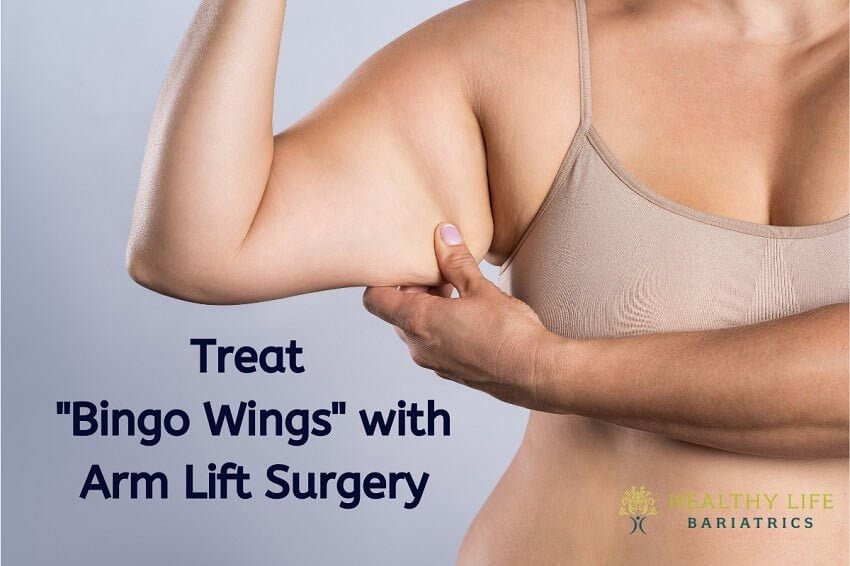 Bingo Wings Removed by Arm Lift/Arm Reduction in LA | HLB