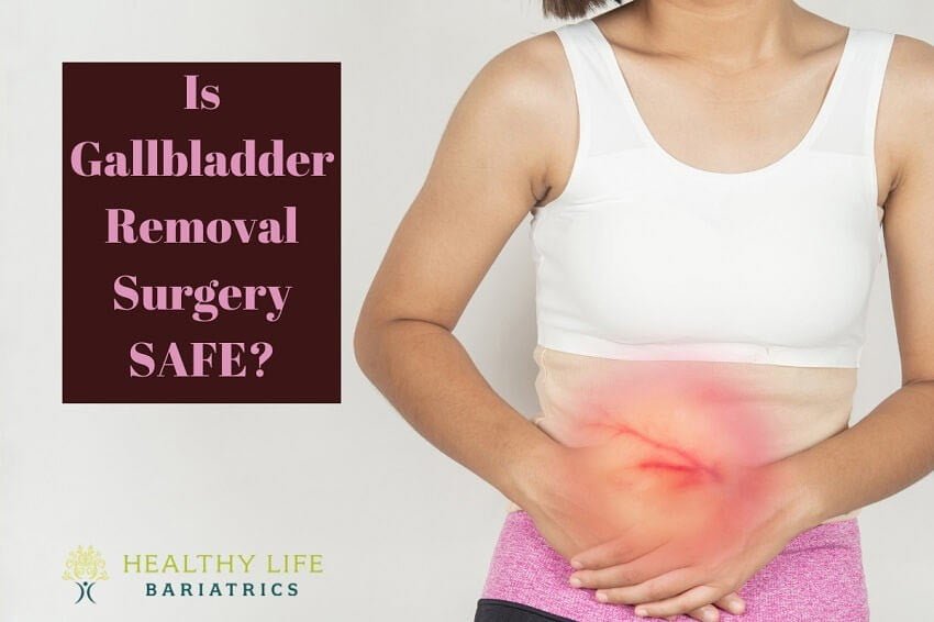 Is Gallbladder Removal SAFE-Los Angeles CA