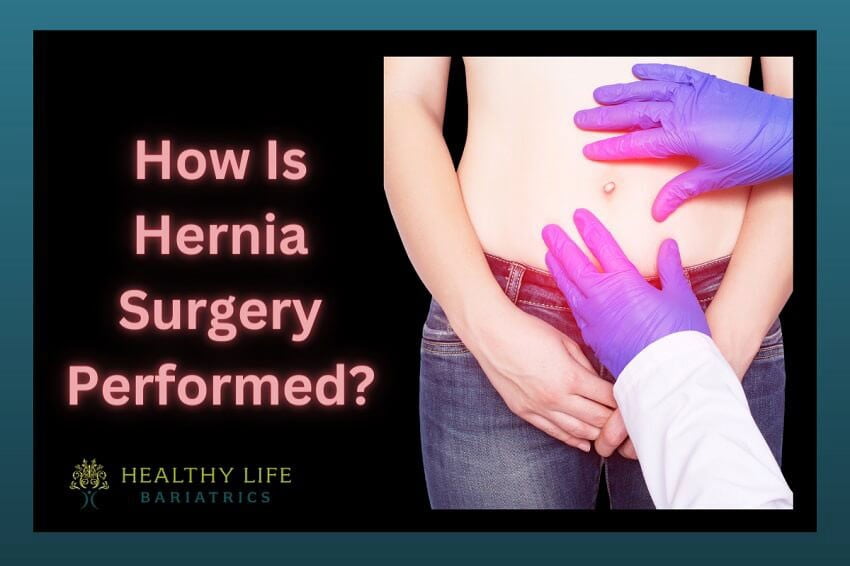 Hernia Surgery Types Performed in Los Angeles, CA