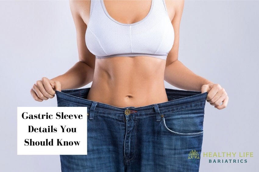 Gastric Sleeve Details