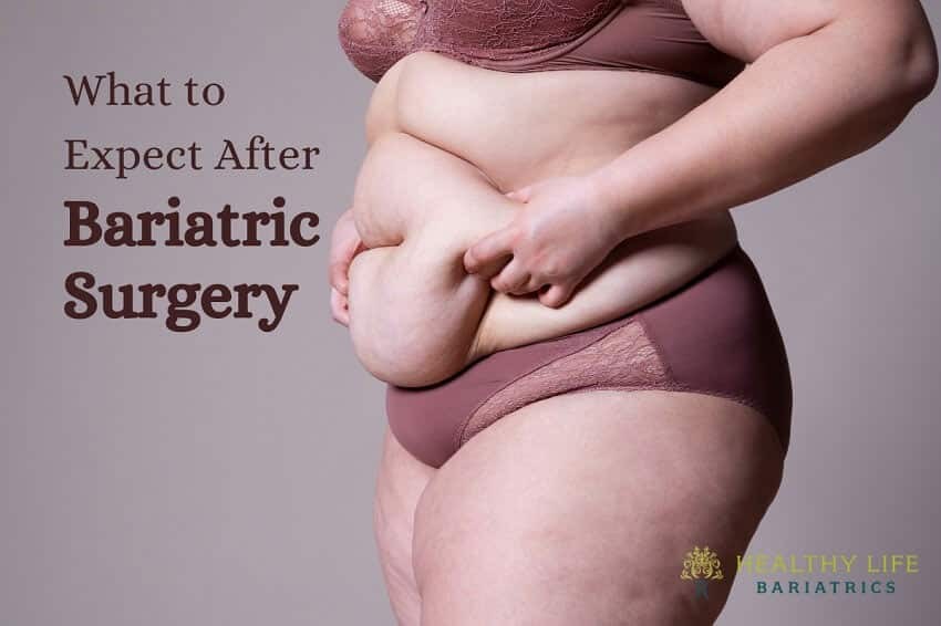 What Can You Expect After Bariatric Surgery?