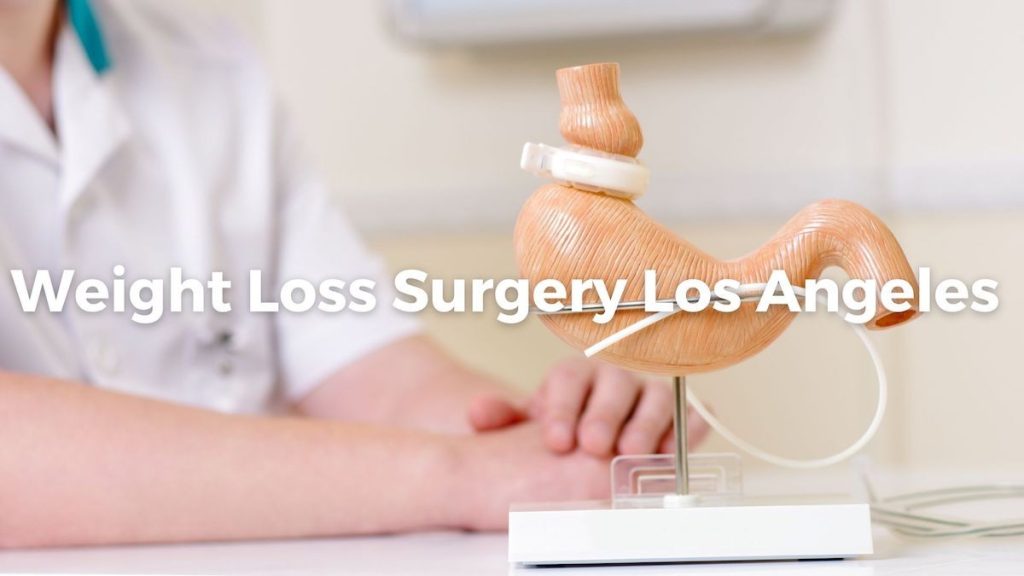 Weight loss surgery