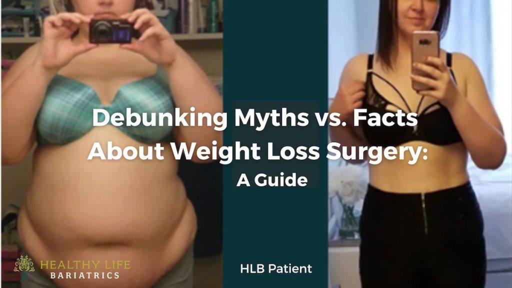 Debunking Myths vs Facts About Weight Loss Surgery