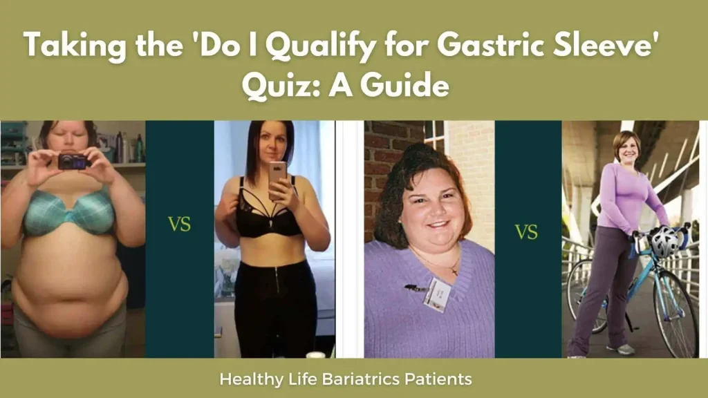 Do I Qualify for Gastric Sleeve'