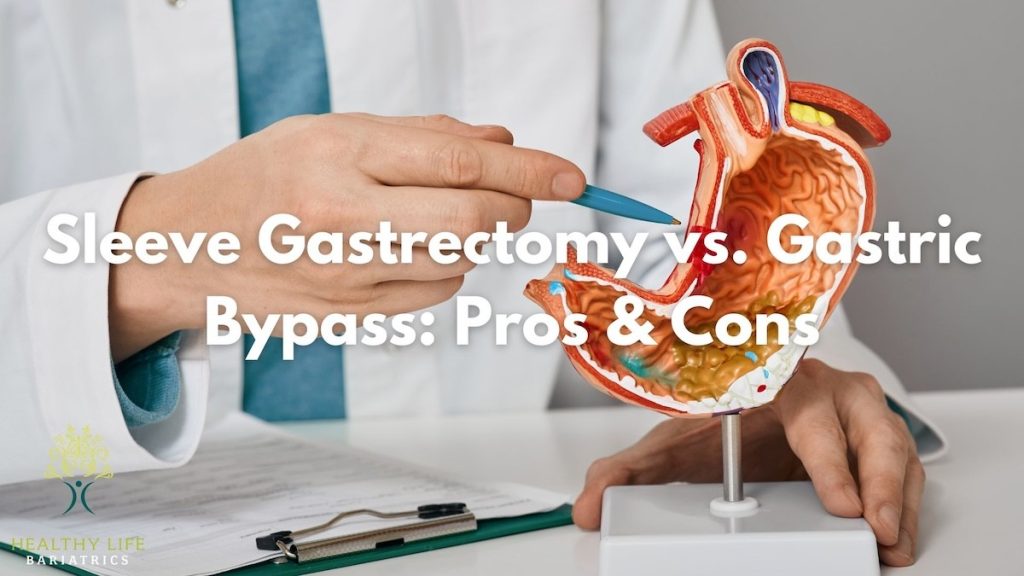 Sleeve Gastrectomy versus Gastric Bypass