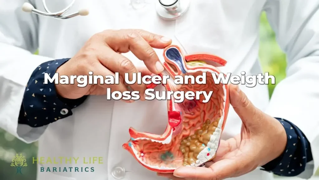 Margarine uie and weight loss surgery.